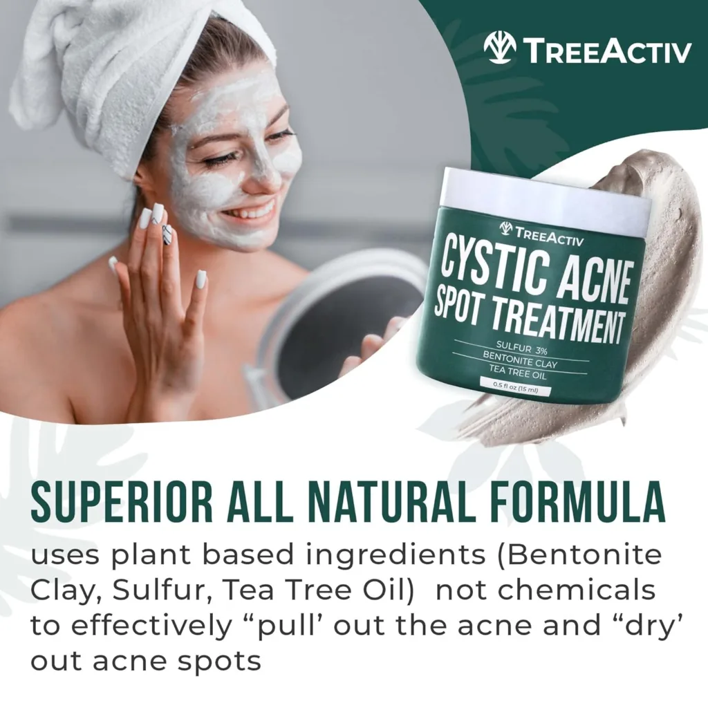 TreeActiv Cystic Acne Spot Treatment, Hormonal  Overnight Sulfur Cystic Treatment For Face, Pimples, and Blemishes for Adults, Men, and Women - 0.5oz 120+ Uses